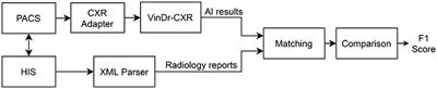 Deployment and validation of an AI system for detecting abnormal chest radiographs in clinical settings
